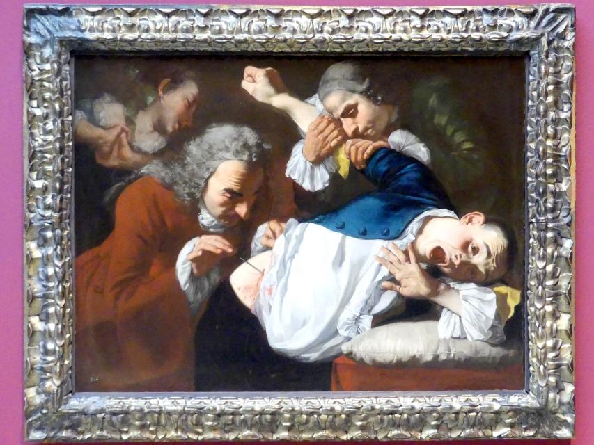 Gaspare Traversi (1750–1753), Die Operation, Stuttgart, Staatsgalerie, Italienische Malerei 1, um 1753–1754, Bild 1/2
