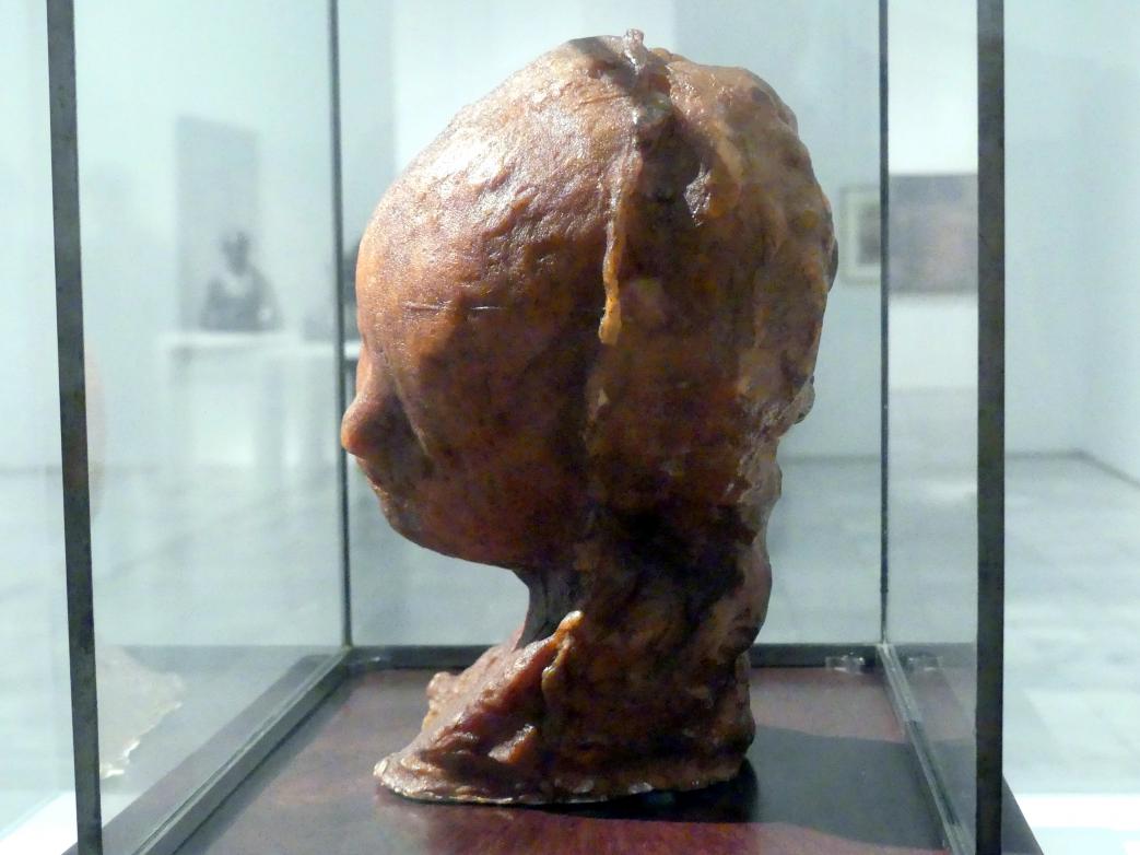 Medardo Rosso (1882–1906), Krankes Kind, Madrid, Museo Reina Sofía, Saal 201.02, 1889–1892, Bild 2/4